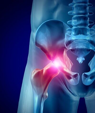 gūžas sāpju foto 1