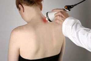 fizioterapija osteohondrozes ārstēšanai